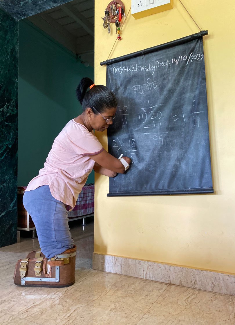 'When the doctors first told me about the operation I went into shock... Since then, every small task takes longer to complete. Even writing with this chalk is difficult'