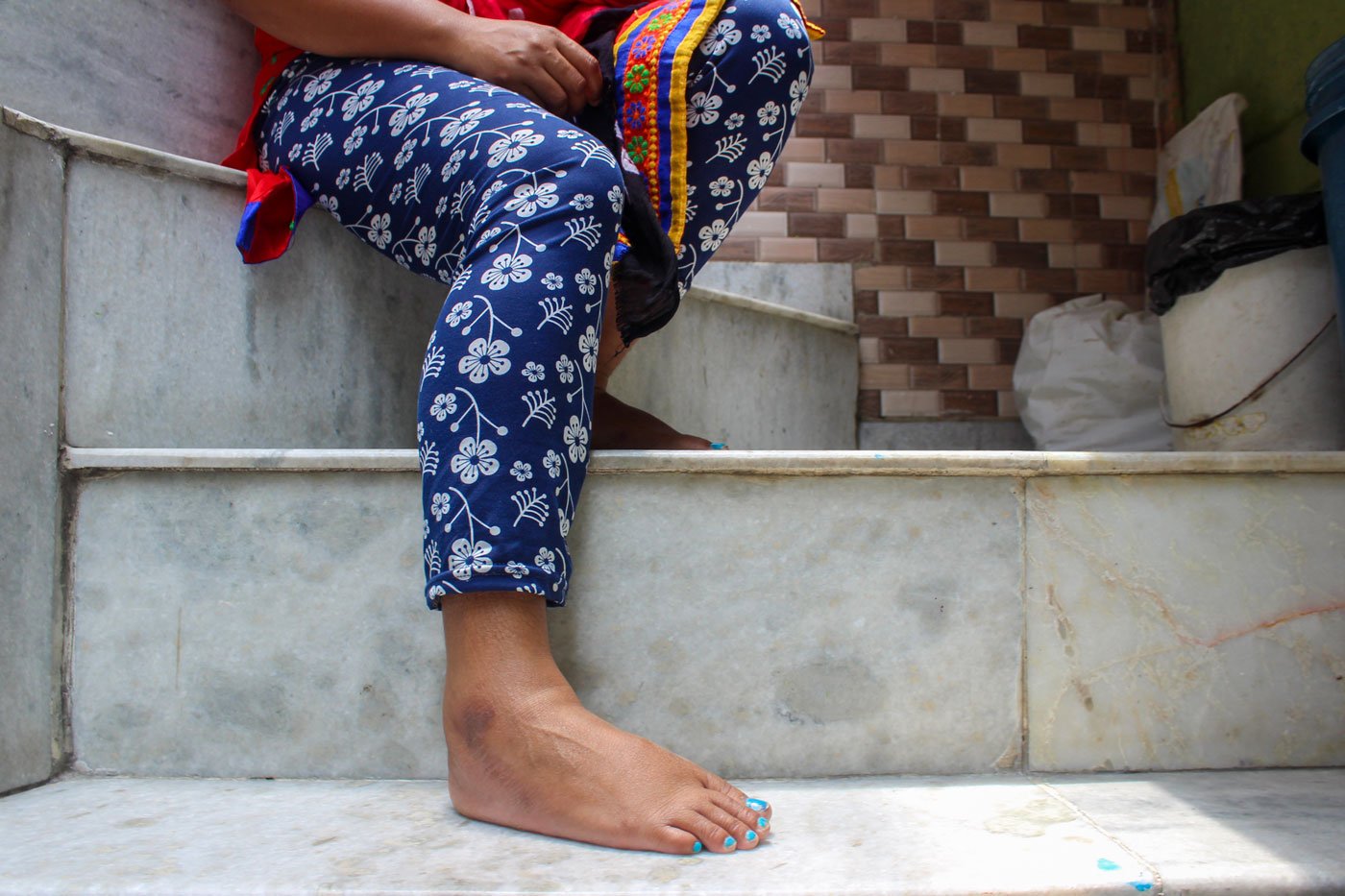 'I felt like killing myself with all that pain and the expenses I knew would follow,' says Honey, who had contracted an STD during her pregnancy