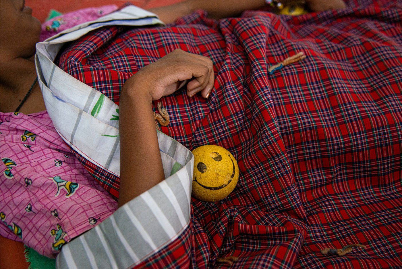 'Tuberculosis has re-emerged as a major public health problem,' says the recent National Family Health Survey 2019-21(NFHS-5). And India accounts for 27 per cent of all TB cases worldwide. A case of tuberculous meningitis that went untreated (left), but is improving with treatment. A patient with pulmonary TB walks with support of a walker (right). It took four months of steady treatment for the this young patient to resume walking with help
