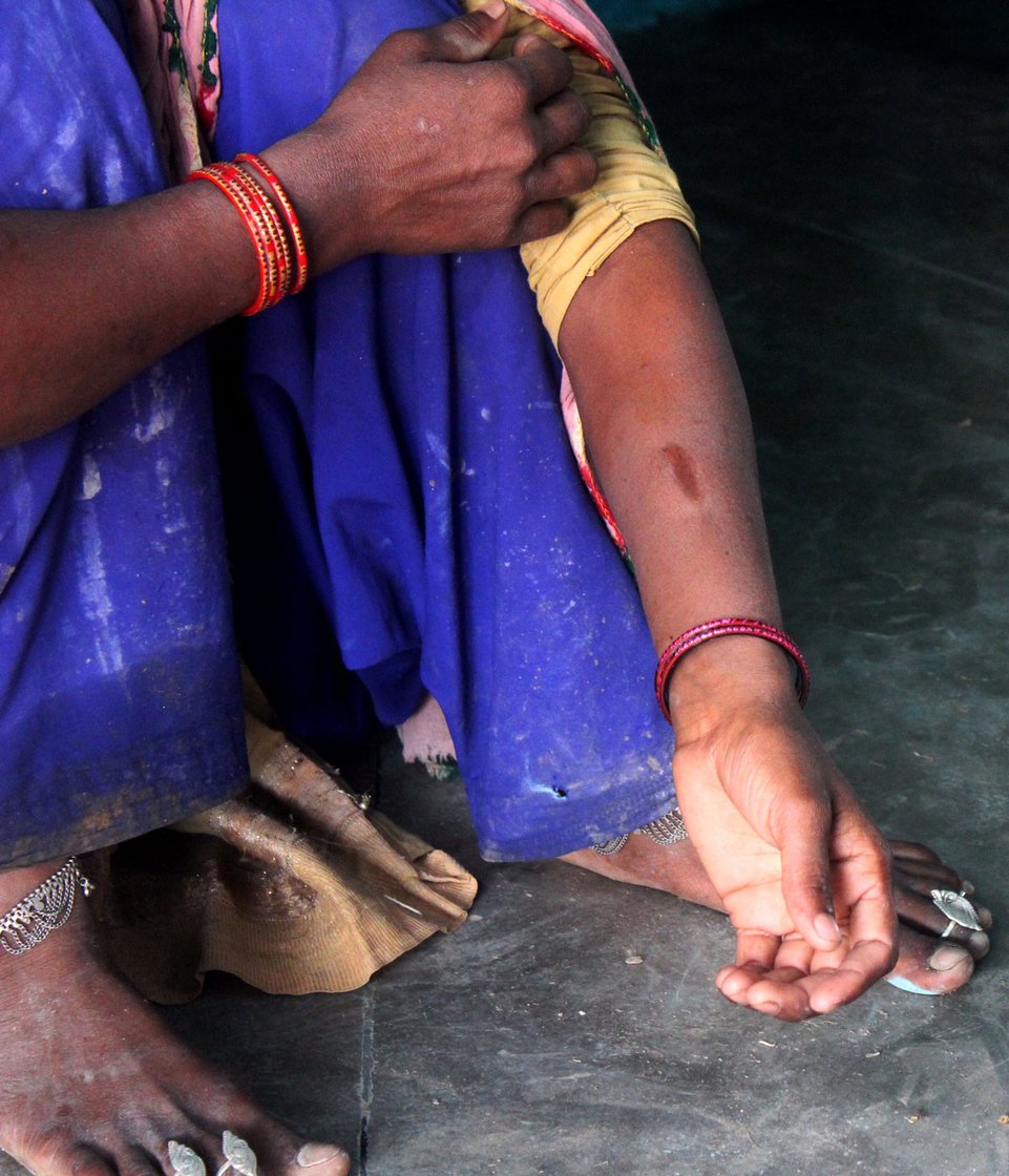 Nageena Khan's bangles broke and pierced the skin recently when her husband hit her. Left: With her younger son