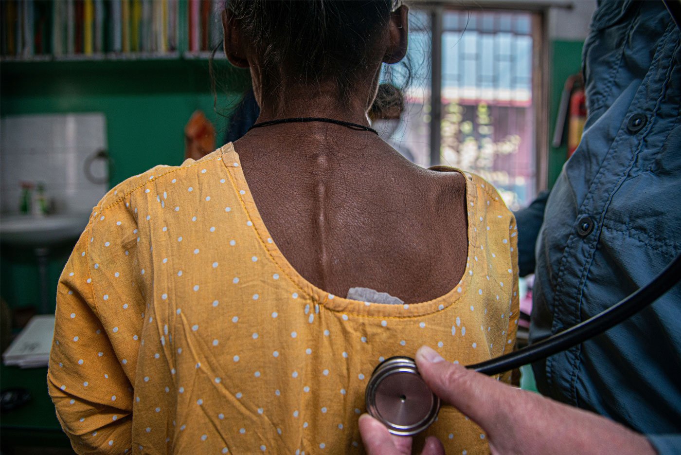 Left: Prolonged use of TB drugs has multiple side effects such as chronic depression.