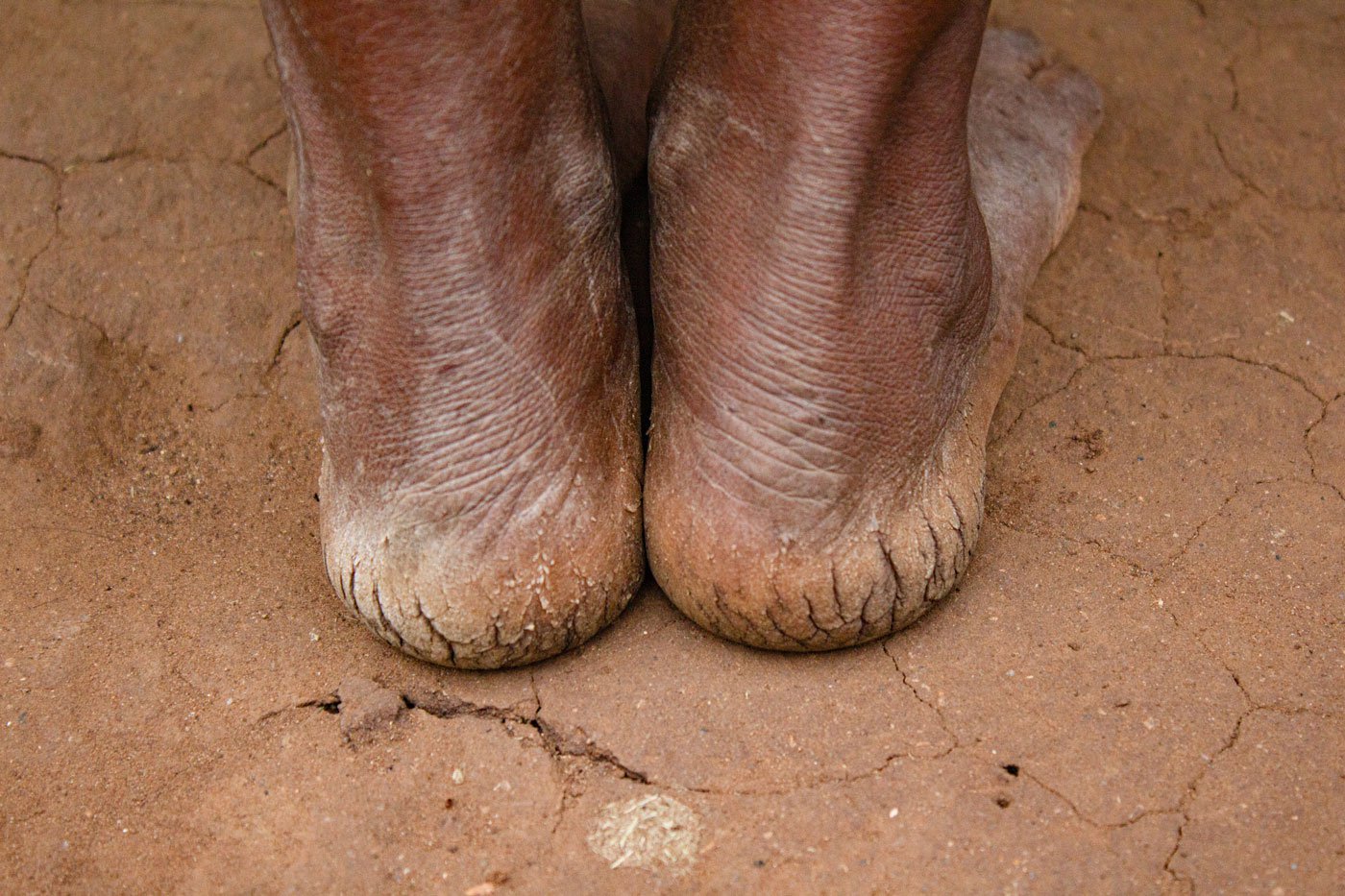 No matter how much my mother works in the water, her cracked feet look like dry, barren land